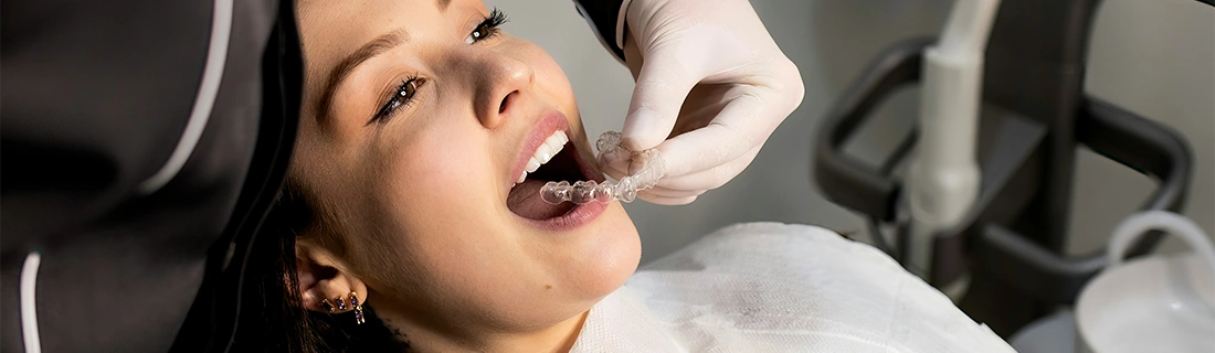 About Invisalign in Miamisburg OH – FC